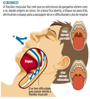 Úvula: 3 problemas que podem acontecer e os cuidados necessários